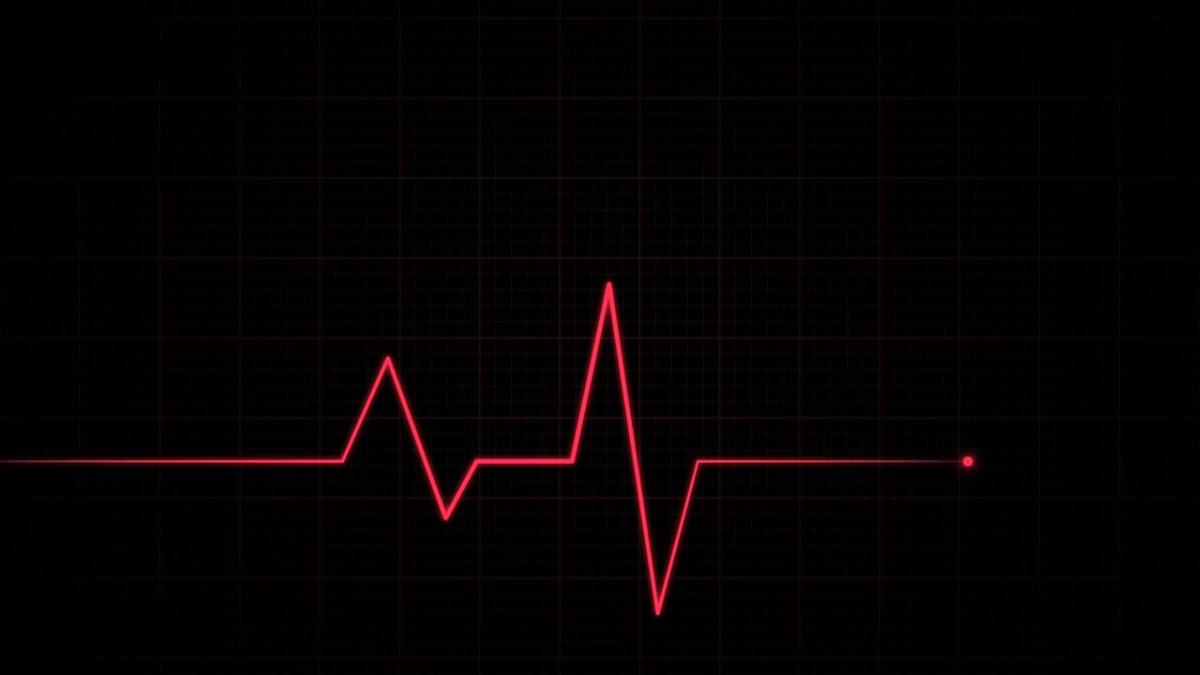 Смерть на ЭКГ