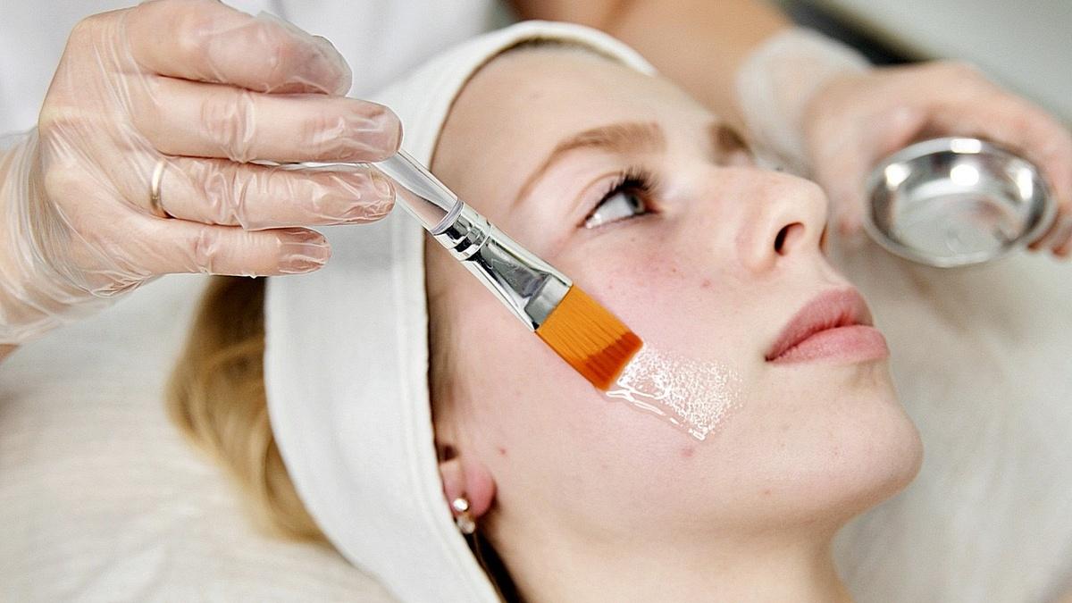 Химический пилинг